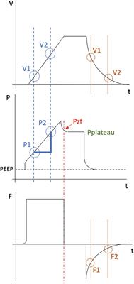 Static and Dynamic Measurements of Compliance and Driving Pressure: A Pilot Study